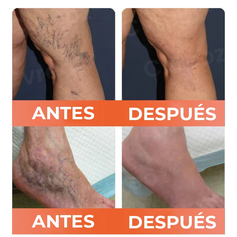 Compra 2 y recibe 2 GRATIS – ¡Total 4 unidades!