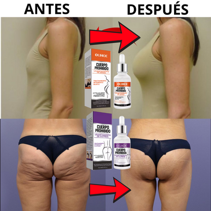 Kit Cuerpo Prohibido – Aumenta Senos y Glúteos