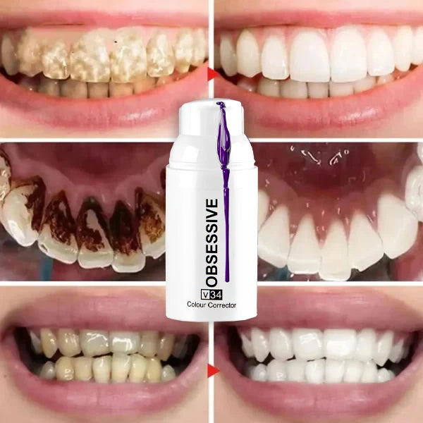 Obsessive –  El Blanqueador Dental Definitivo