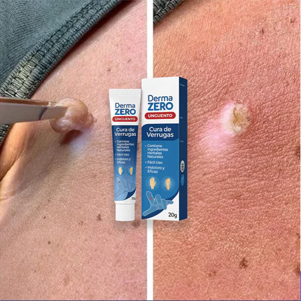 El Eliminador Definitivo de Verrugas - DermaZero + 1 GRATIS