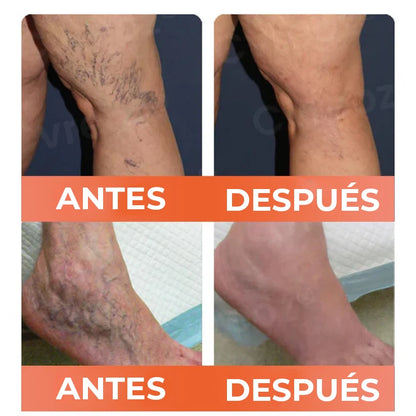 Compra 2 y recibe 2 GRATIS – ¡Total 4 unidades!