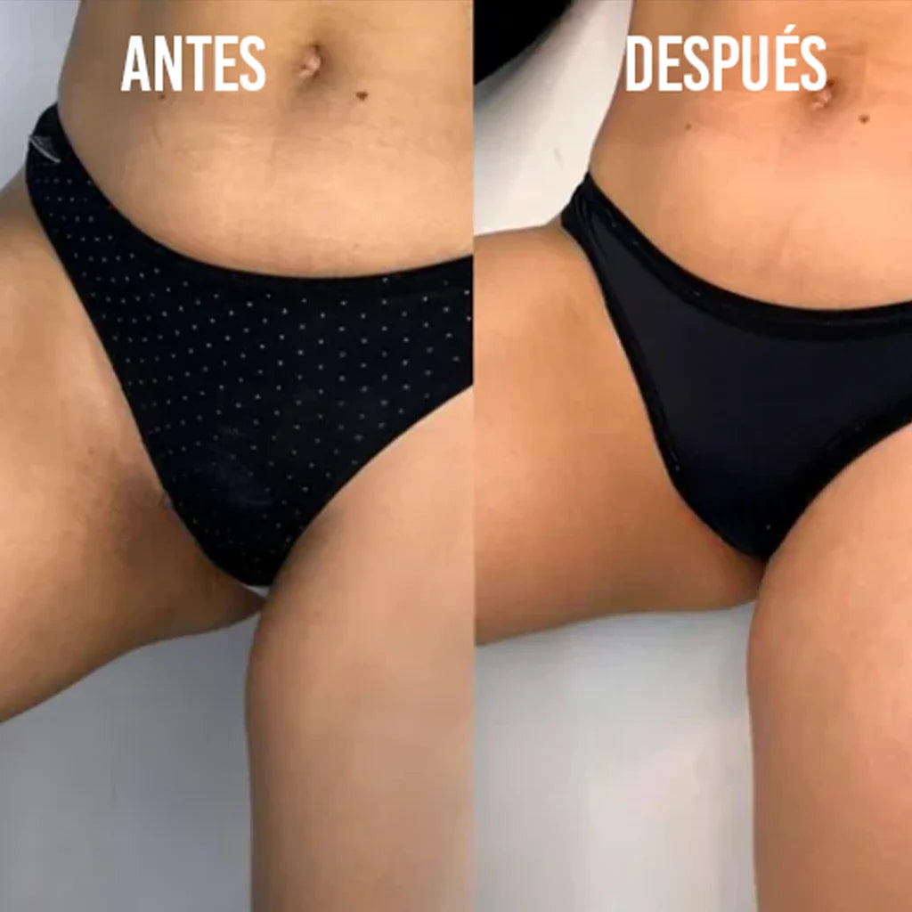 ¡Adiós Manchas Oscuras! DermaLuz aclara visiblemente tu piel desde la primera semana.