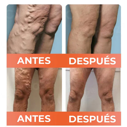 Compra 2 y recibe 2 GRATIS – ¡Total 4 unidades!