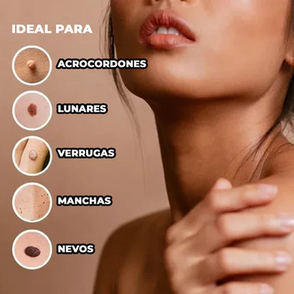 El Eliminador Definitivo de Verrugas - DermaZero + 1 GRATIS