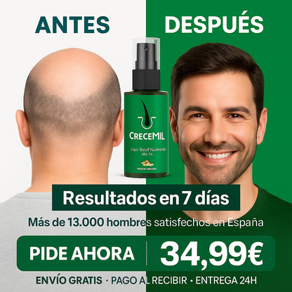 CRECEMIL – Spray de Crecimiento Rápido para Hombres con Calvicie